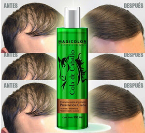 Magicolor Patented Hair Beard Growth Shampoo Cola de Caballo Concentrado 315 ML